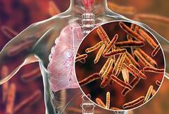 कई साल में पहली बार बढ़ी टीबी रोगियों की संख्या, यह वायरस बना जिम्मेदार