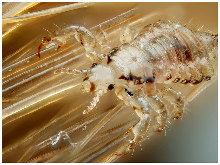 where-do-lice-come-from-in-our-head-know-here-lice