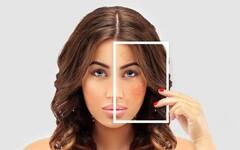 Pigmentation Skin Care : ਨਹੀਂ ਪਵੇਗੀ ਮਹਿੰਗੀਆਂ ਕਰੀਮਾਂ ਤੇ ਪਾਰਲਰ ਟ੍ਰੀਟਮੈਂਟ ਦੀ ਲੋੜ, ਇਨ੍ਹਾਂ ਘਰੇਲੂ ਨੁਸਖਿਆਂ ਨਾਲ ਦੂਰ ਕਰੋ ਚਿਹਰੇ ਦੀਆਂ ਝੁਰੜੀਆਂ