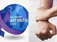 World Arthritis Day 2022: நாளை உலக ஆர்த்ரைட்டிஸ் நாள்.. மருத்துவர்கள் சொல்லும் ஆலோசனைகள் என்ன?