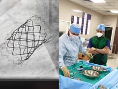 सेना के अस्पताल का कमाल, 15 साल के बच्चे का बिना सर्जरी के हार्ट में किया वॉल्व रिप्लेसमेंट