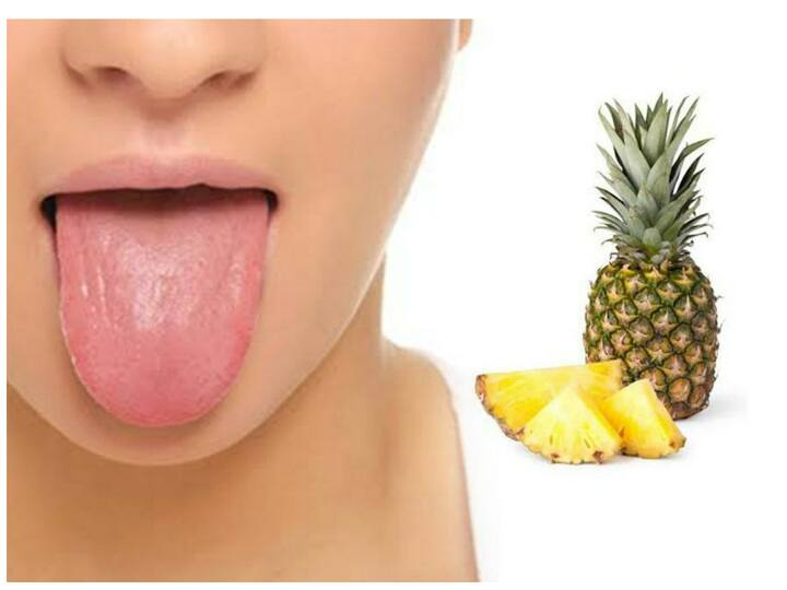 why tongue tingling after eating pineapple why pineapple tastes like