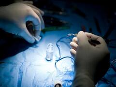 सरगुजा में चिरायु टीम की पहल से लौट आई बच्ची की आंखों की रोशनी, जन्म से थी मोतियाबिंद से पीड़ित