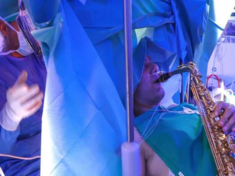 Patient Undergoes Complex 9 Hour Long Brain Surgery While Playing Saxophone 9 மணி நேரம்... சாக்ஸபோனை வாசித்தபடியே அறுவை சிகிச்சை செய்து கொண்ட நபர்