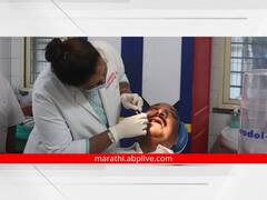 PHOTO: पालकमंत्री शासकीय रुग्णालयाच्या पाहणी दौऱ्यावर आले अन् दातांचे उपचारही करून गेले