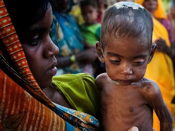 India Falls To 107 From 101 In Global Hunger Index Behind Pakistan Nepal Global Hunger : பட்டினியால் வாடும் இந்தியா..! பாகிஸ்தான், வங்கதேசத்தை காட்டிலும் மோசமான நிலை..! அதிர்ச்சி தரும் அறிக்கை..