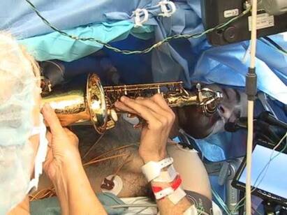 Musician plays saxophone while undergoing a complex nine hour brain surgery Viral Video : மூளையில் அறுவை சிகிச்சை..! ஹாயாக படுத்து சாக்ஸோபோன் வாசித்த நோயாளி..!