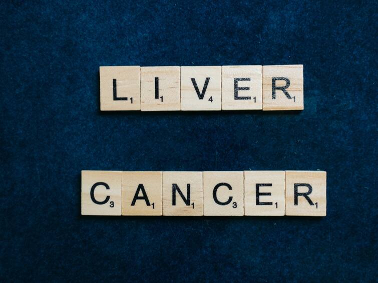 These are the precautions to prevent liver cirrhosis from turning into liver cancer Liver Cancer: ‘లివర్ సిర్రోసిస్’ అంటే ఏమిటీ? అది కాలేయ క్యాన్సర్‌‌గా మారకూడదంటే ఏం చేయాలి?