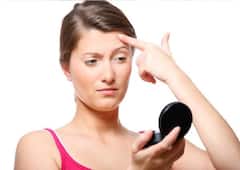 Skin Care Tips: এই সহজ পদ্ধতিগুলোতেই দূর হবে ব্রণর সমস্যা