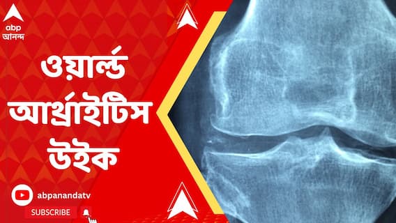 বাত নিয়ে SSKM হাসপাতালে হল আলোচনাসভা, রোগ ও তার উপসর্গ নিয়ে সচেতনতায় জোর