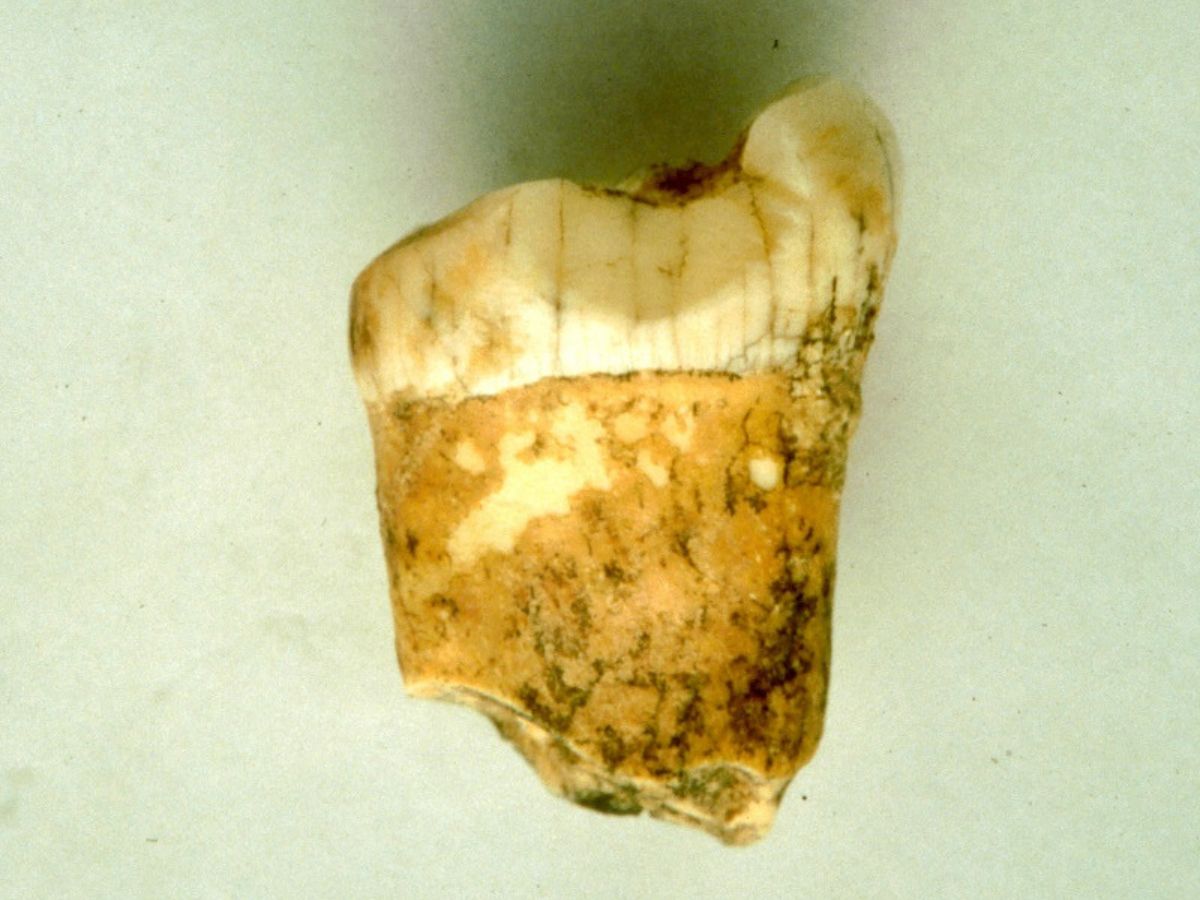 Neanderthals Consumed Meat But Not Blood, Clues From A Tooth Reveal