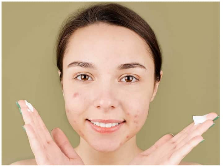 How to get rid of acne scars naturally acne scars home remedies Acne Scars: इन चार प्रोडक्ट्स से नेचुरली पाएं एक्ने स्कार्स से मुक्ति, आज ही ट्राय करें ये टिप्स