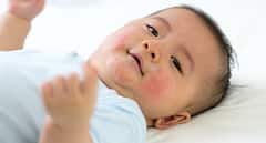 Food Allergy: બાળકને સ્કિન પર વારંવાર થઇ જાય છે ફોલ્લીઓ તો હોઇ શકે છે કારણ