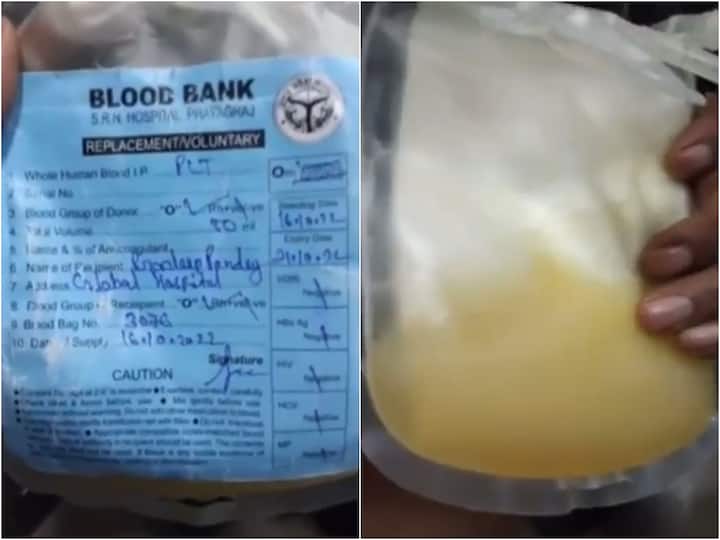 Viral Video Claims Dengue Patient Died After Mosambi Juice Drip In UP, Probe Ordered Viral Video: రోగికి ప్లాస్మా బదులు బత్తాయి జ్యూస్ ఎక్కించిన వైద్యులు- బాధితుడు మృతి!