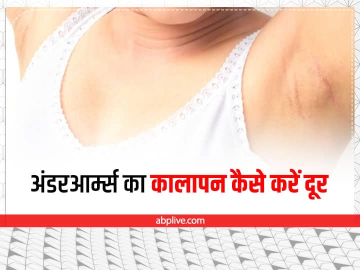 homemade pack for Dark underarms अंडरआर्म्स का कालापन दूर करने में असरदार हैं ये पैक, ऐसे करें घर पर तैयार