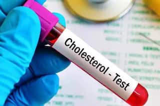Cholesterol Level : कोलेस्ट्रॉल पातळीची उच्च सीमारेषा काय? निरोगी व्यक्तीमध्ये कोलेस्ट्रॉल किती असावे? जाणून घ्या सविस्तर