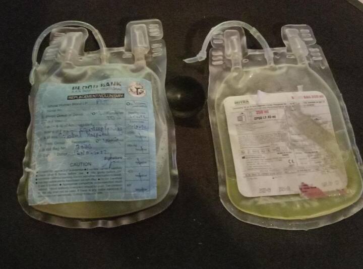 Dengue cases increasing steadily dearth of platelets in Kokata blood banks Dengue Situation: রাজ্যে ডেঙ্গি পরিস্থিতি ভয়ঙ্কর, কলকাতার ব্লাড ব্যাঙ্কে প্লেটলেটের আকাল