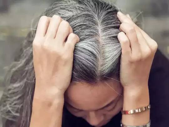 Premature Graying Of Hair: If the hair starts turning white before age, then do this remedy, add these things in the diet. Premature Greying Of Hair : ਜੇਕਰ ਉਮਰ ਤੋਂ ਪਹਿਲਾਂ ਸਫ਼ੇਦ ਹੋਣ ਲੱਗਣ ਵਾਲ ਤਾਂ ਕਰੋ ਇਹ ਉਪਾਅ, ਡਾਈਟ 'ਚ ਸ਼ਾਮਿਲ ਕਰੋ ਇਹ ਚੀਜ਼ਾਂ