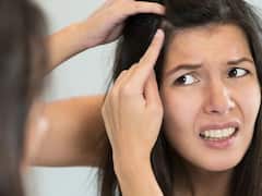 Premature Greying Of Hair : ਬਸ ਡਾਈਟ 'ਚ ਸ਼ਾਮਿਲ ਕਰੋ ਇਹ ਚੀਜ਼ਾਂ, ਸਮੇਂ ਤੋਂ ਪਹਿਲਾਂ ਸਫੈਦ ਨਹੀਂ ਹੋਣਗੇ ਵਾਲ