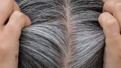Premature Greying Of Hair : ਬਸ ਡਾਈਟ 'ਚ ਸ਼ਾਮਿਲ ਕਰੋ ਇਹ ਚੀਜ਼ਾਂ, ਸਮੇਂ ਤੋਂ ਪਹਿਲਾਂ ਸਫੈਦ ਨਹੀਂ ਹੋਣਗੇ ਵਾਲ