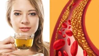 Heart care : સાવધાન, બેડ કોલેસ્ટ્રોલ બની શકે છે જીવલેણ, જાણો ઘટાડવા શું ખાવું અને શું નહિ