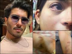 इस पाकिस्तानी एक्टर ने  की थी पत्नी की बुरी तरह पिटाई! तस्वीरें देख दहल जाएगा आपका भी दिल