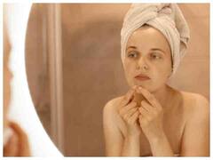 पुराने निशान बिगाड़ रहे हैं आपका लुक तो अब आजमाएं देसी नुस्खे, दिखेगा गजब का असर 