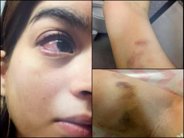 इस पाकिस्तानी एक्टर ने पत्नी की बुरी तरह की थी पिटाई! तस्वीरें देख दहल जाएगा आपका भी दिल