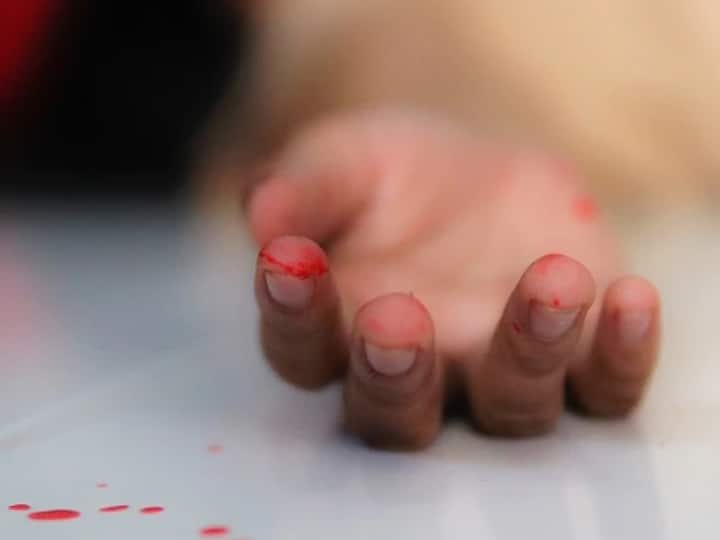 Aravalli News: 2500 रुपये नहीं लौटाने पर युवक का काटा हाथ, पुलिस ने किया एक को गिरफ्तार Aravali Hand cut off for not returning 2500 rupees Gujarat Aravalli News: 2500 रुपये नहीं लौटाने पर युवक का काटा हाथ, पुलिस ने किया एक को गिरफ्तार