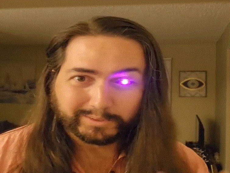 US Man Loses Eye To Cancer Creates Prosthetic Eye With A Flashlight US Man Loses Eye To Cancer, Creates Prosthetic Eye With A Flashlight