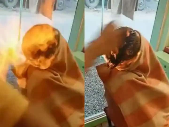 Gujarat News Man Suffers Burns After Fire Haircut Goes Wrong At Salon Video Goes Viral Gujarat News: 'ఫైర్ హెయిర్ కట్' చేయిస్తున్నారా? ఓ సారి ఈ వీడియోపై లుక్కేయండి!