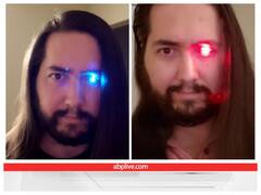 कैंसर की वजह से आंख की रोशनी गई तो आंख की जगह फ्लैशलाइट ही फिक्स करा ली! वाह