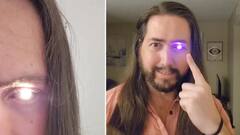 Weird News: ਵਿਅਕਤੀ ਨੇ ਆਪਣੀ ਅੱਖ 'ਚ ਹੀ ਲਗਾਈ ਫਲੈਸ਼ ਲਾਈਟ, ਕਾਰਨ ਜਾਣ ਕੇ ਰਹਿ ਜਾਓਗੇ ਹੈਰਾਨ