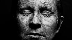 Lifestyle: রুক্ষ-শুষ্ক ত্বকের র‍্যাশ, চুলকানির সমস্যা কমানোর সহজ উপায়