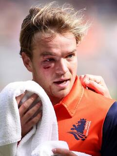 రక్తాలు చిందాయ్ - టీ20 ప్రపంచకప్ పాకిస్తాన్, నెదర్లాండ్స్ మ్యాచ్ హైలెట్స్!