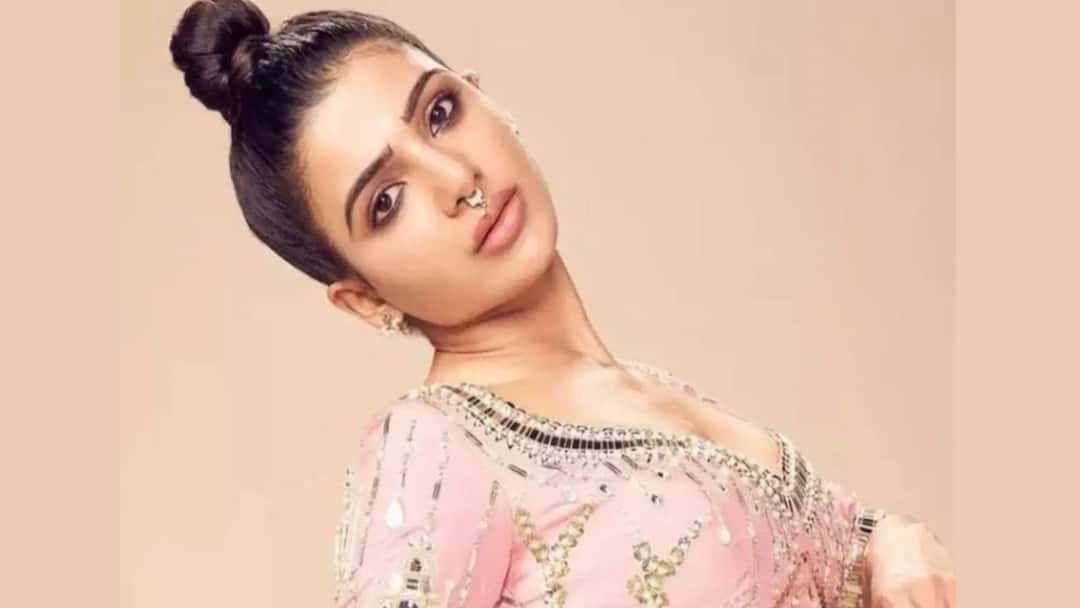 Samantha Ruth Prabhu Is Suffering From Myositis. All About The Rare Autoimmune Condition, know in details Samantha Prabhu Health: কী এই মায়োসাইটিস? যে রোগে আক্রান্ত সামান্থা