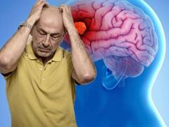 ब्रेन ट्यूमर के शुरुआती लक्षण दिखते हैं बेहद मामूली इसे न करें इग्नोर, ऐसे करें बचाव
