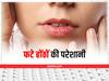 Dry Lips Remedies: सर्दियों में फटे होंठों से हैं परेशान, इन उपायों से पाएं छुटकारा