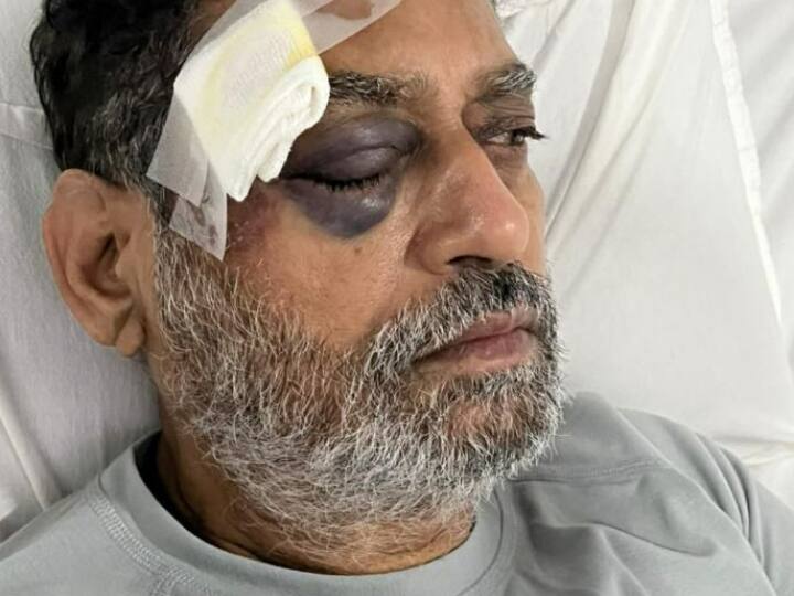 Today 56th day of Bharat Jodo Yatra former minister nitin raut hospitalized after being injured by police in Hyderabad Bharat Jodo Yatra: भारत जोड़ो यात्रा का आज 56वां दिन, हैदराबाद में पुलिस के धक्के से घायल हुए पूर्व मंत्री राउत अस्पताल में भर्ती