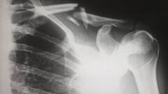 Lung Disease : ਵੈੱਟ ਲੰਗ ਡਿਸੀਜ਼ ਦੇ ਲੱਛਣ ਦਿਸਣ ਤਾਂ ਪਰੇਸ਼ਾਨ ਨਾ ਹੋਵੋ, ਤੁਰੰਤ ਕਰੋ ਇਹ ਕੰਮ