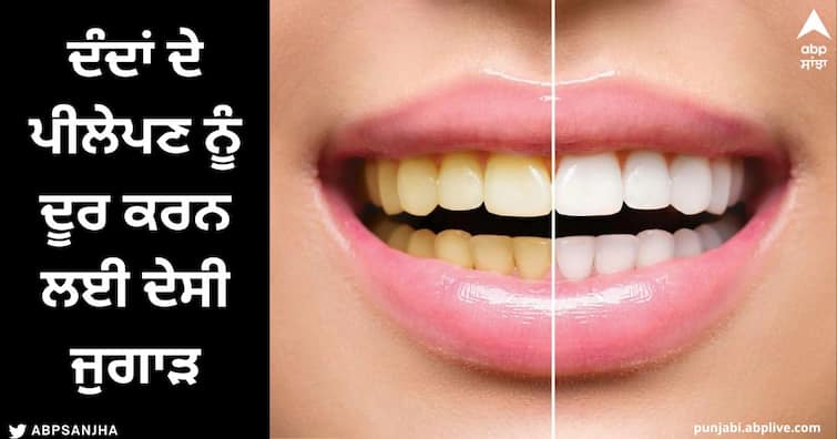 Whiten Teeth : Desi trick to remove the yellowness of the teeth, the teeth will shine like a pearl in just 5 minutes. Whiten Teeth : ਦੰਦਾਂ ਦੇ ਪੀਲੇਪਣ ਨੂੰ ਦੂਰ ਕਰਨ ਲਈ ਦੇਸੀ ਜੁਗਾੜ, ਸਿਰਫ 5 ਮਿੰਟਾਂ 'ਚ ਮੋਤੀ ਵਾਂਗ ਚਮਕ ਜਾਣਗੇ ਦੰਦ