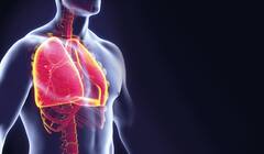 Lung Disease : ਵੈੱਟ ਲੰਗ ਡਿਸੀਜ਼ ਦੇ ਲੱਛਣ ਦਿਸਣ ਤਾਂ ਪਰੇਸ਼ਾਨ ਨਾ ਹੋਵੋ, ਤੁਰੰਤ ਕਰੋ ਇਹ ਕੰਮ