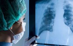 Lung Disease : ਵੈੱਟ ਲੰਗ ਡਿਸੀਜ਼ ਦੇ ਲੱਛਣ ਦਿਸਣ ਤਾਂ ਪਰੇਸ਼ਾਨ ਨਾ ਹੋਵੋ, ਤੁਰੰਤ ਕਰੋ ਇਹ ਕੰਮ