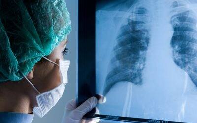 ਫੇਫੜੇ ਹਵਾ ਖਿੱਚ ਕੇ ਸਰੀਰ ਦੇ ਇੱਕ ਮਹੱਤਵਪੂਰਨ ਹਿੱਸੇ ਦਿਲ ਨੂੰ ਆਕਸੀਜਨ ਪਹੁੰਚਾਉਂਦੇ ਹਨ। ਦਿਲ ਇਸ ਆਕਸੀਜਨ ਨੂੰ ਦੂਜੇ ਅੰਗਾਂ ਨੂੰ ਸਪਲਾਈ ਕਰਦਾ ਹੈ।