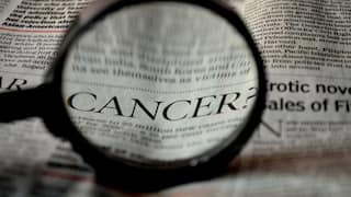 Cancer in Children : वेळेवर निदान आणि उपचार, लहान मुलांमधील 80 टक्के कर्करोग बरे होऊ शकतात; लहान मुलांना होणारे कर्करोग कोणते?