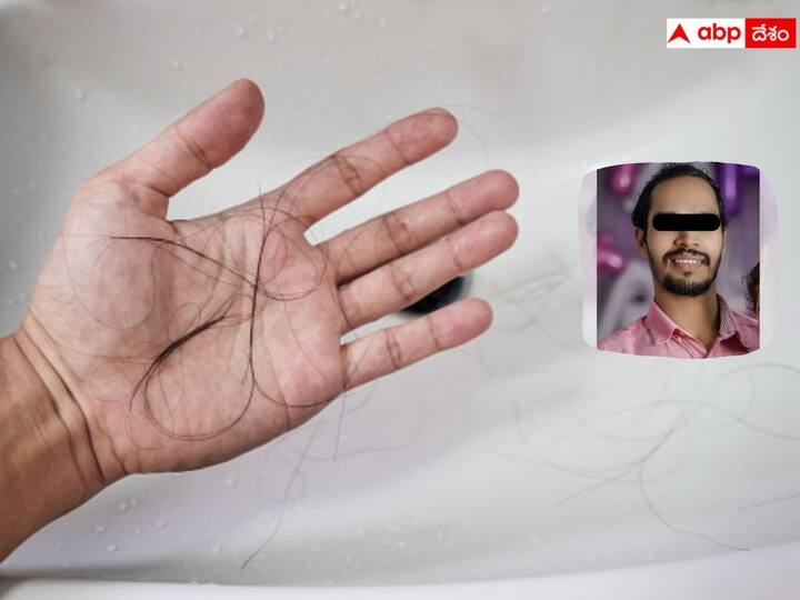 A 29-year-old mechanic from Atholi, Kozhikode district in Kerala committed suicide after getting upset over hair loss. జుట్టు రాలిపోతోంది, పెళ్లికి అమ్మాయిలు దొరకడం లేదు, మానసిక క్షోభతో యువకుడు ఆత్మహత్య!