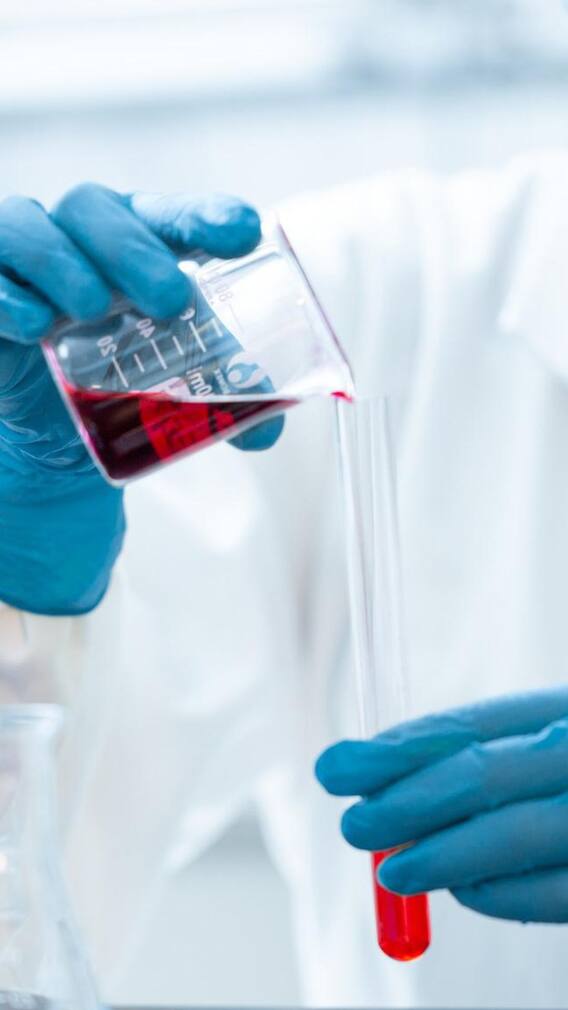 জ্বর হলে, ডেঙ্গি হয়েছে কিনা কী করে বুঝবেন ?