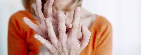 Health Tips : ਗਠੀਏ 'ਚ ਖਾਂਦੇ ਹੋ ਇਹ ਫੂਡ ਆਈਟਮਸ ਤਾਂ ਅੱਜ ਤੋਂ ਹੀ ਬਣਾ ਲਓ ਦੂਰੀ, ਨਹੀਂ ਤਾਂ ਹੋ ਸਕਦੇ ਗੰਭੀਰ ਨਤੀਜੇ