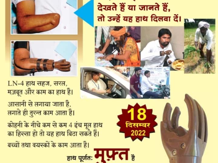 Durg: अमेरिका में बने कृत्रिम हाथ से लोगों को मिलेगा नया जीवन, जानिए- कब से शुरू होगा शिविर Durg People will get new life with artificial hand made in America know when camp will start ANN Durg: अमेरिका में बने कृत्रिम हाथ से लोगों को मिलेगा नया जीवन, जानिए- कब से शुरू होगा शिविर
