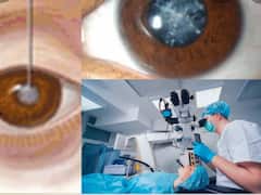 छत्तीसगढ़: मोतियाबिंद के ऑपरेशन में छत्तीसगढ़ का यह जिला देश में अव्वल, केंद्र सरकार ने भी की तारीफ